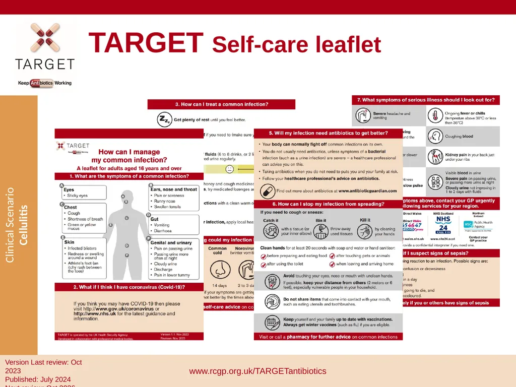 Clinical Scenario: Cellulitis People with dark - slide 12 of 17