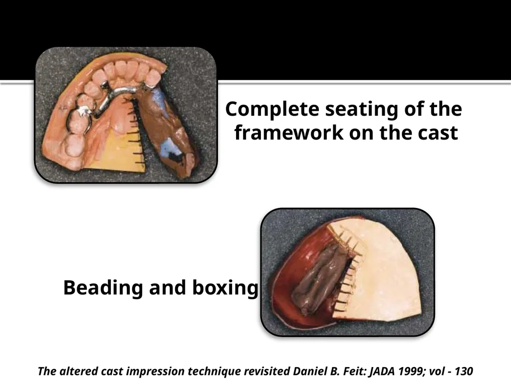 IMPRESSION PROCEDURES FOR REMOVABLE PARTIAL - slide 26 of 30