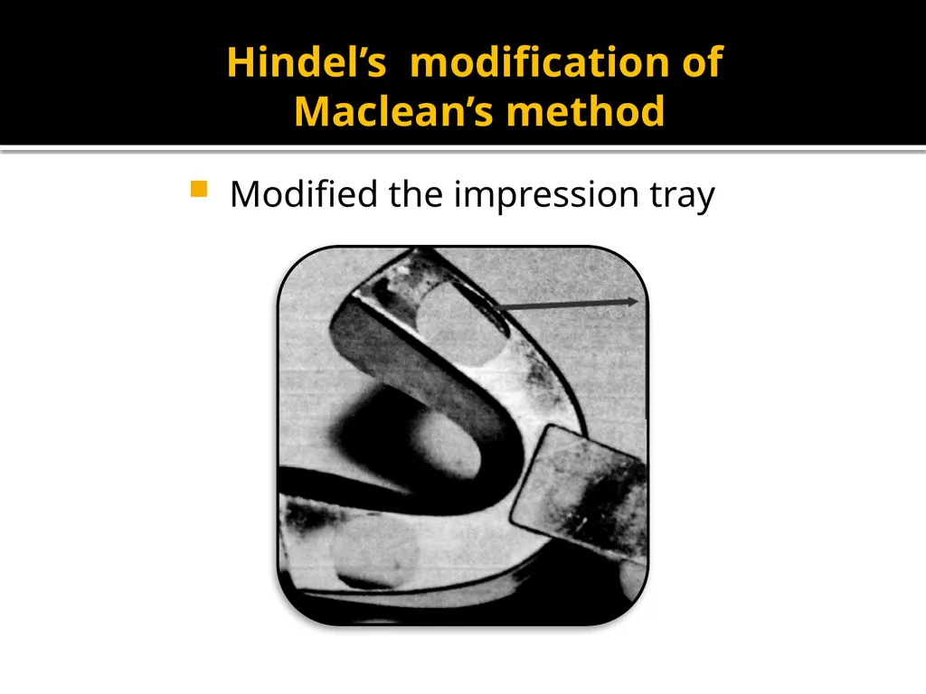 IMPRESSION PROCEDURES FOR REMOVABLE PARTIAL - slide 10 of 30