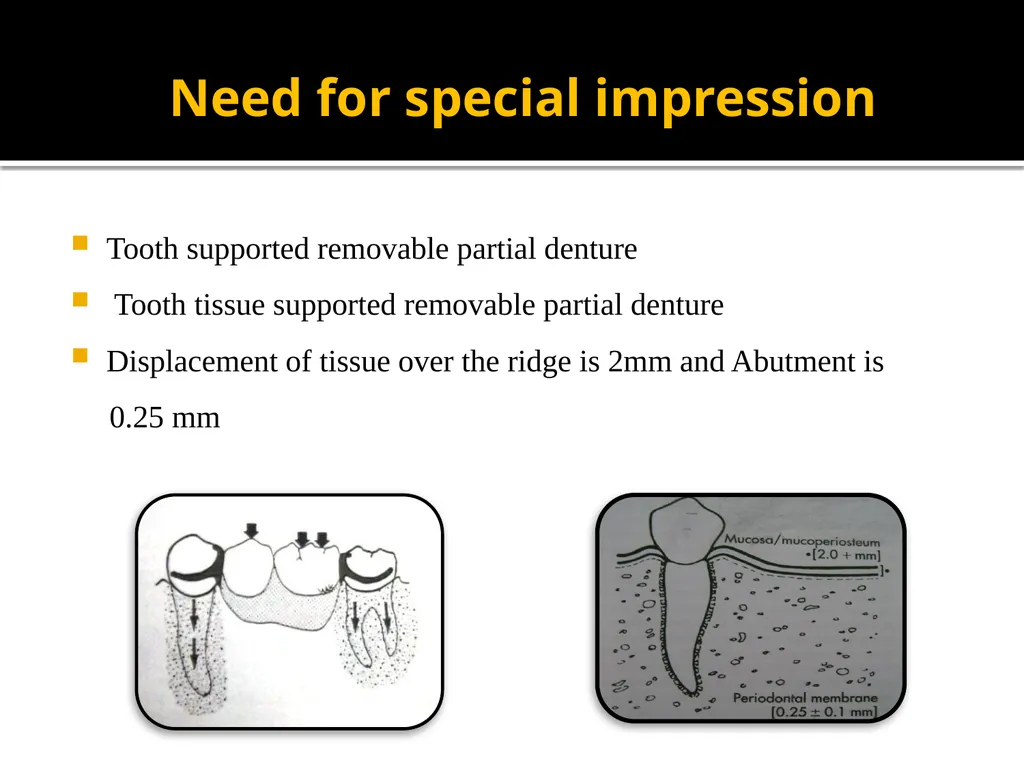 IMPRESSION PROCEDURES FOR REMOVABLE PARTIAL - slide 4 of 30