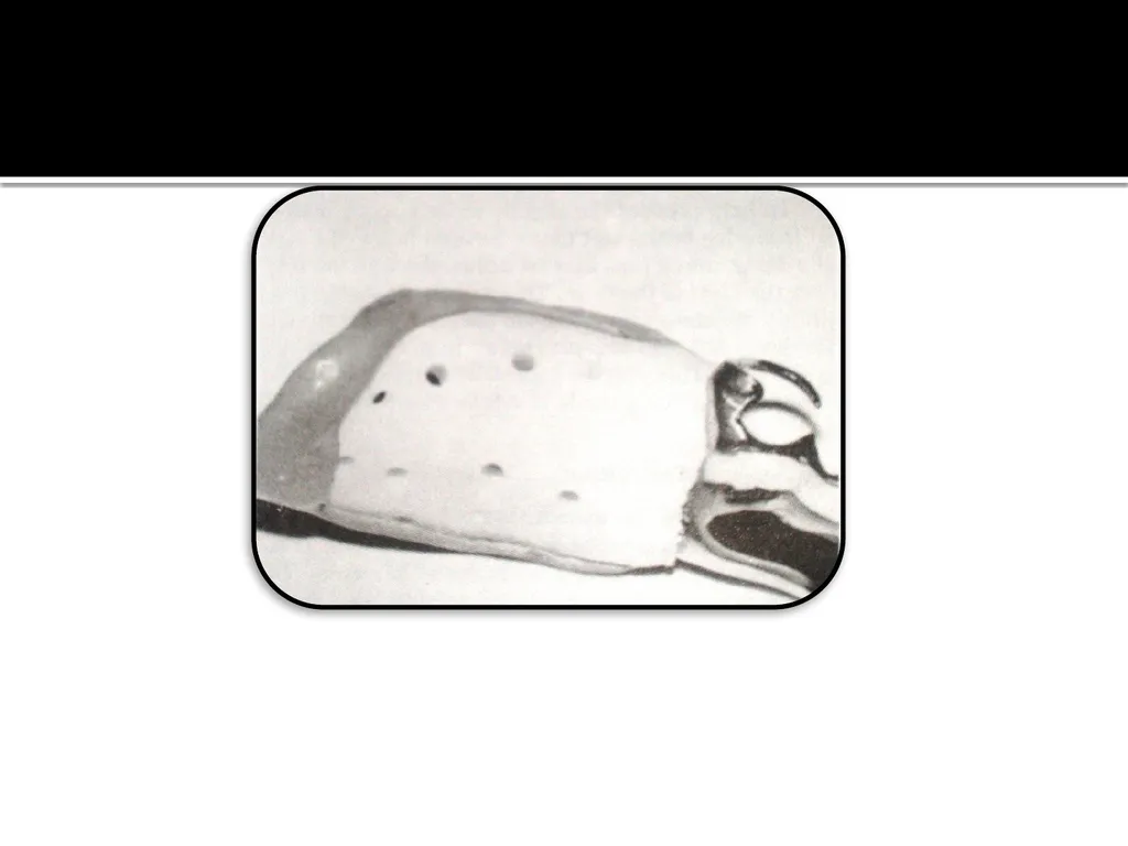 IMPRESSION PROCEDURES FOR REMOVABLE PARTIAL - slide 22 of 30