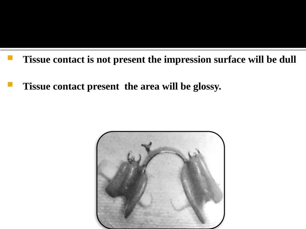 IMPRESSION PROCEDURES FOR REMOVABLE PARTIAL - slide 17 of 30