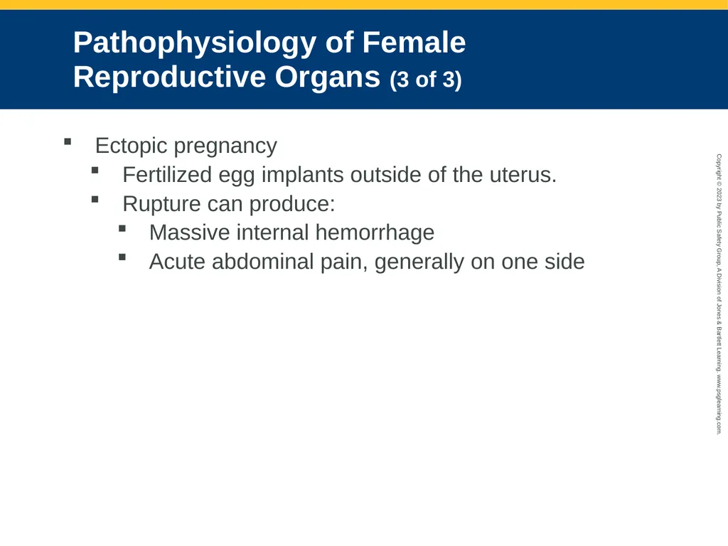 Gastrointestinal and Urologic Emergencies CHAPTER - slide 55 of 89