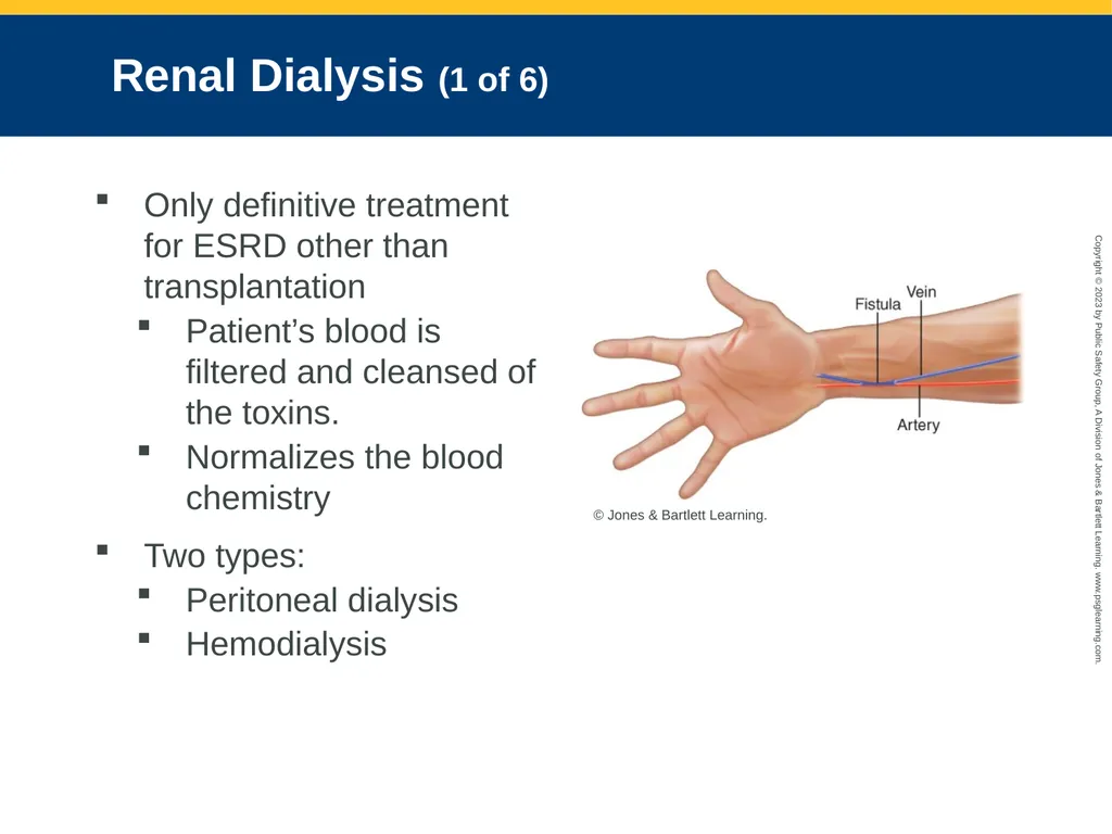 Gastrointestinal and Urologic Emergencies CHAPTER - slide 84 of 89