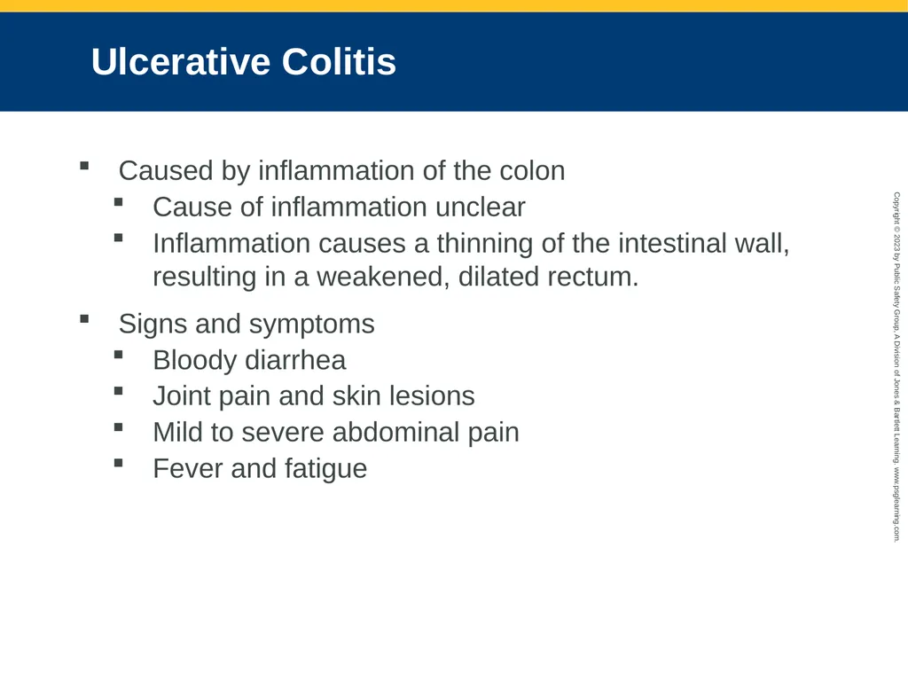 Gastrointestinal and Urologic Emergencies CHAPTER - slide 39 of 89