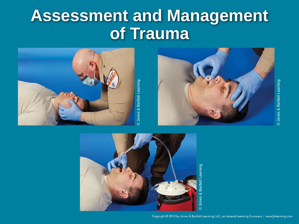 Chapter 44 Geriatric Emergencies Introduction - slide 228 of 242