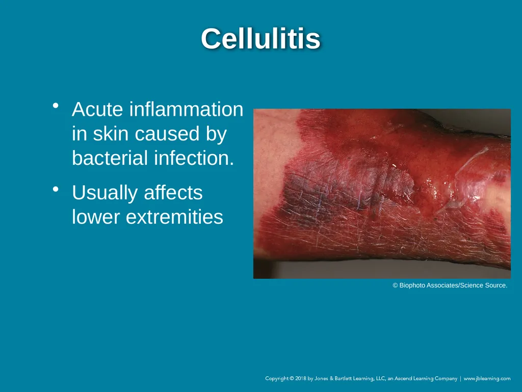 Chapter 44 Geriatric Emergencies Introduction - slide 195 of 242