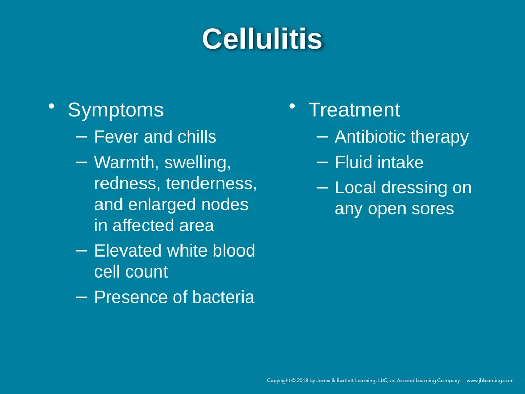 Chapter 44 Geriatric Emergencies Introduction - slide 196 of 242