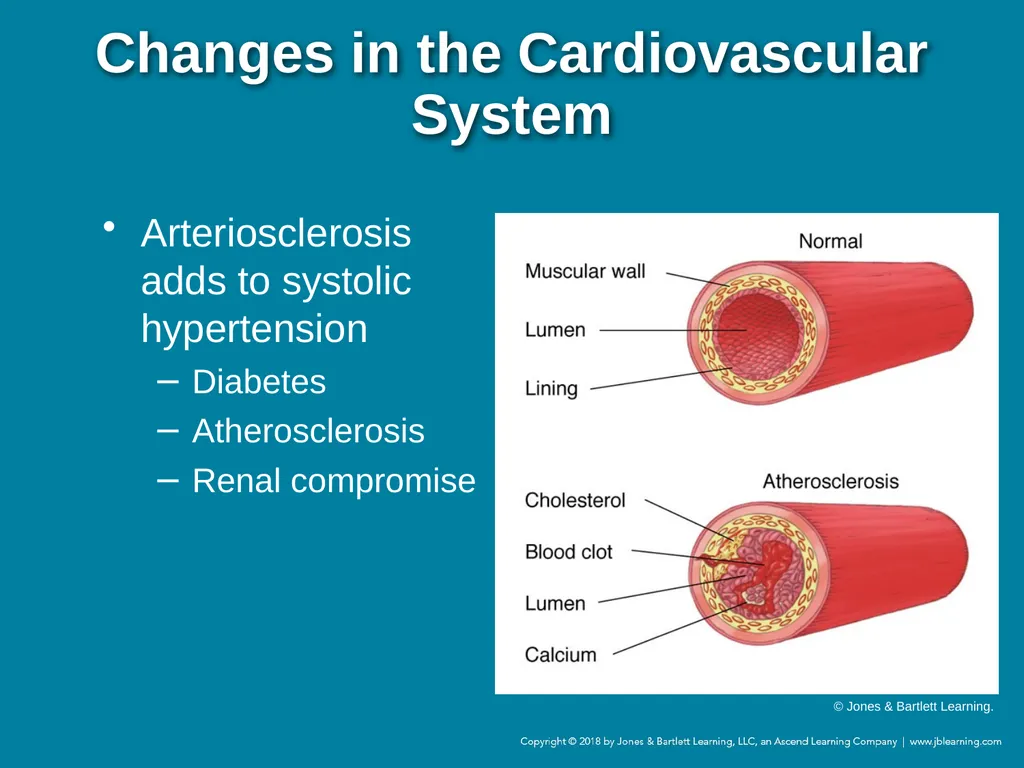 Chapter 44 Geriatric Emergencies Introduction - slide 18 of 242