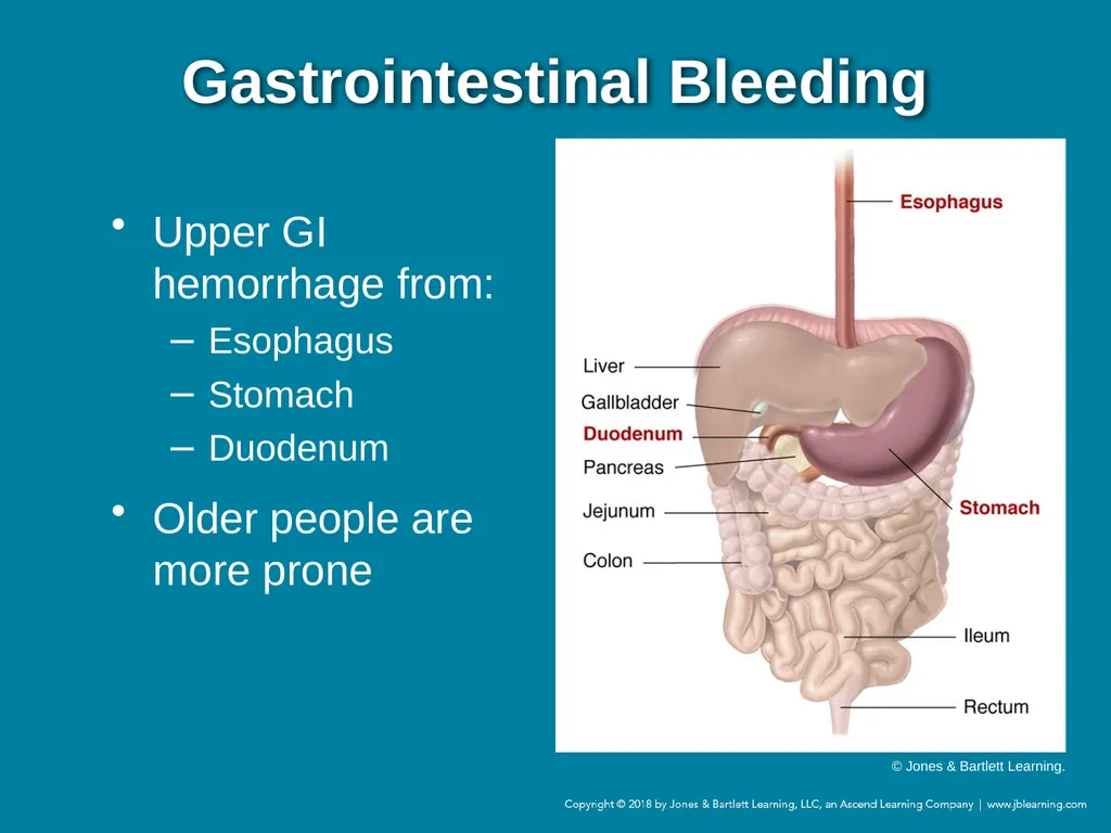 Chapter 44 Geriatric Emergencies Introduction - slide 139 of 242
