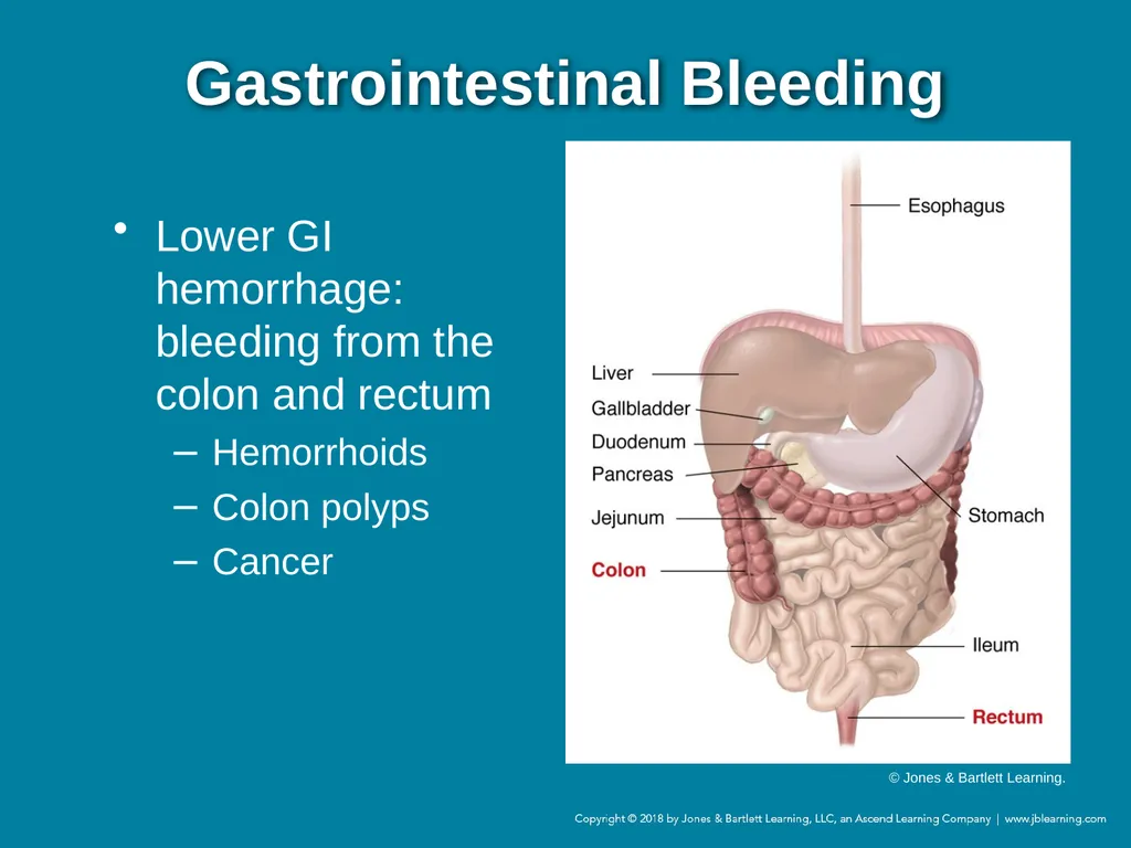 Chapter 44 Geriatric Emergencies Introduction - slide 140 of 242