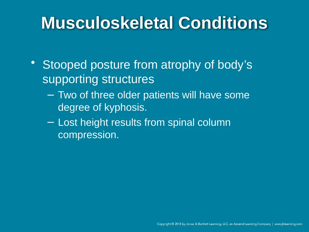 Chapter 44 Geriatric Emergencies Introduction - slide 202 of 242