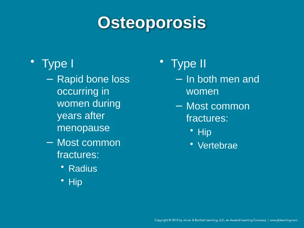 Chapter 44 Geriatric Emergencies Introduction - slide 204 of 242
