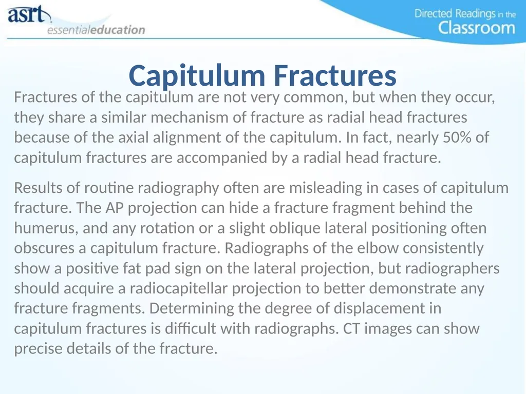 Elbow Injuries Directed Readings In the Classroom - slide 55 of 66