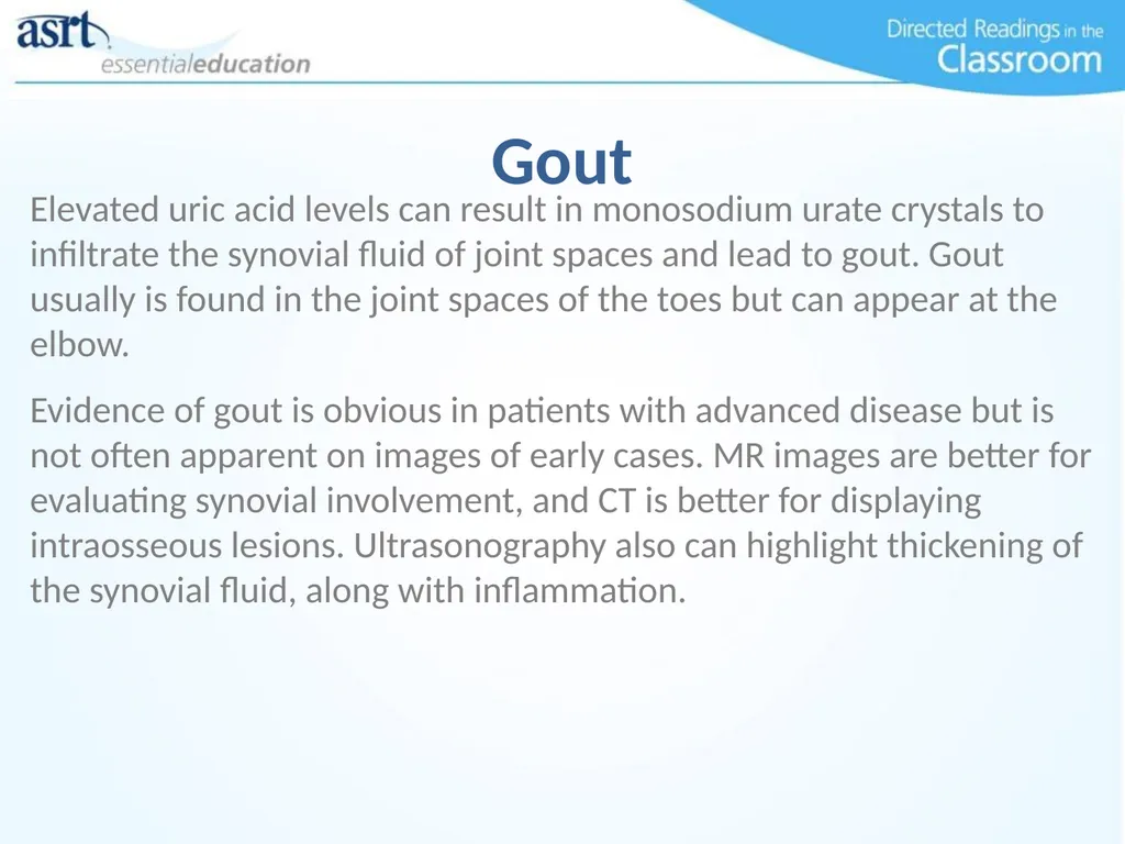 Elbow Injuries Directed Readings In the Classroom - slide 36 of 66