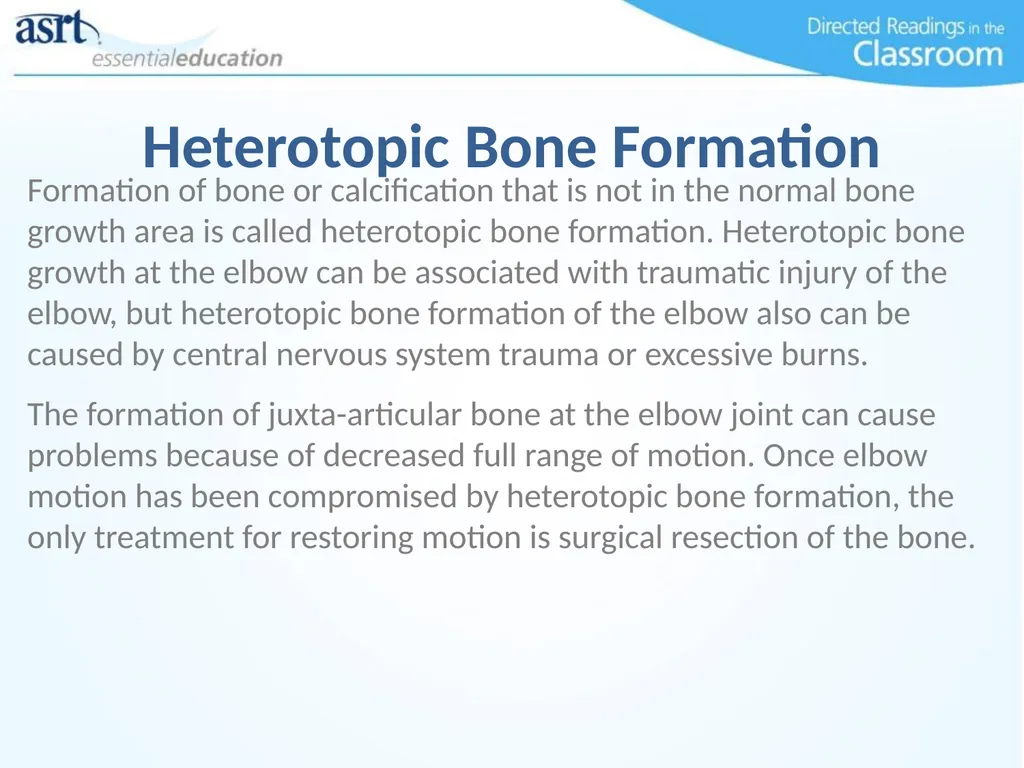 Elbow Injuries Directed Readings In the Classroom - slide 47 of 66