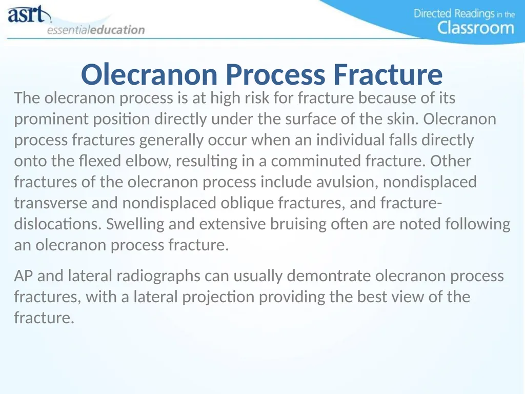 Elbow Injuries Directed Readings In the Classroom - slide 51 of 66