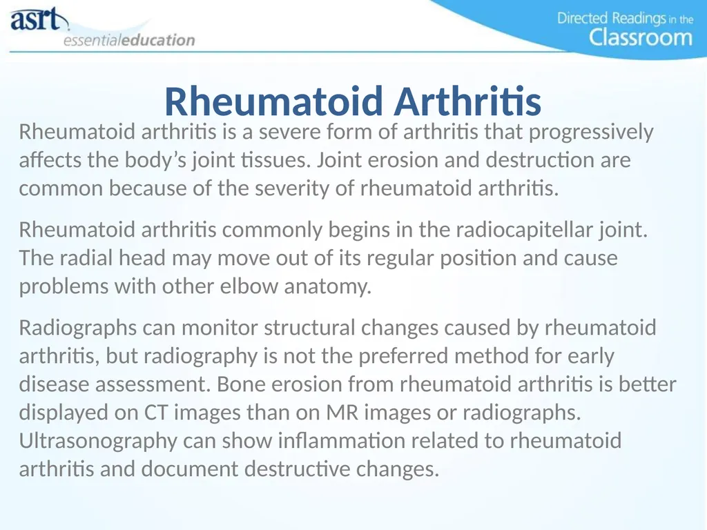 Elbow Injuries Directed Readings In the Classroom - slide 34 of 66