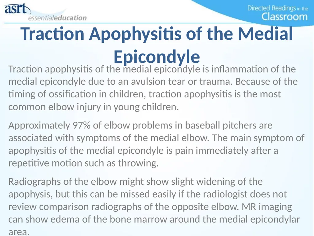 Elbow Injuries Directed Readings In the Classroom - slide 38 of 66