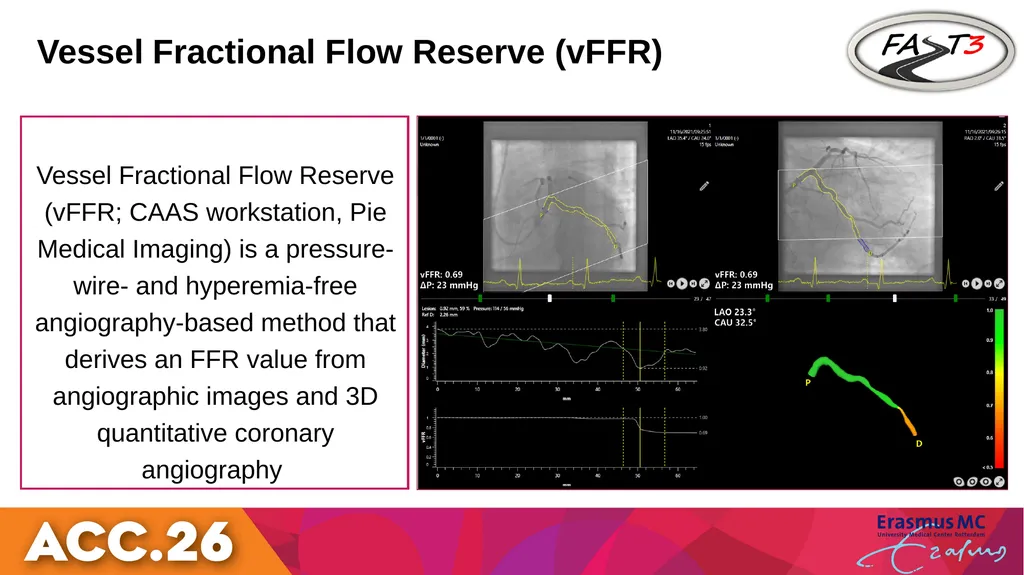 Fractional Flow Reserve or - slide 6 of 23