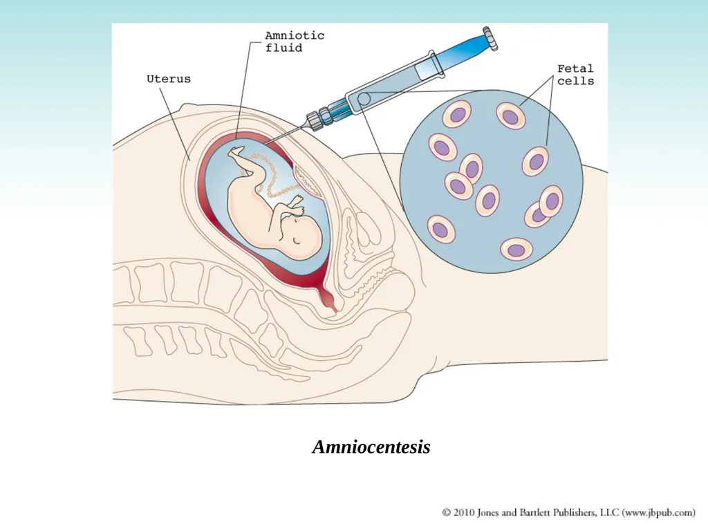 Chapter 9 Congenital and Hereditary Diseases - slide 46 of 50