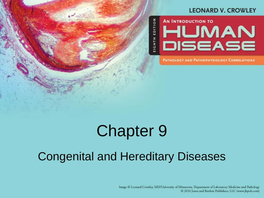 Chapter 9 Congenital and Hereditary Diseases - slide 1 of 50
