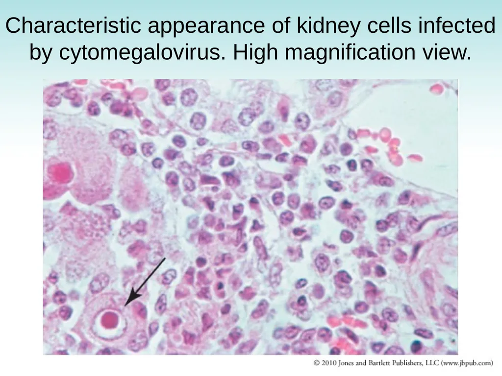 Chapter 9 Congenital and Hereditary Diseases - slide 38 of 50
