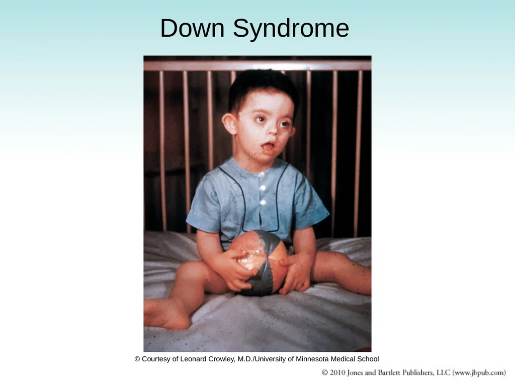 Chapter 9 Congenital and Hereditary Diseases - slide 27 of 50