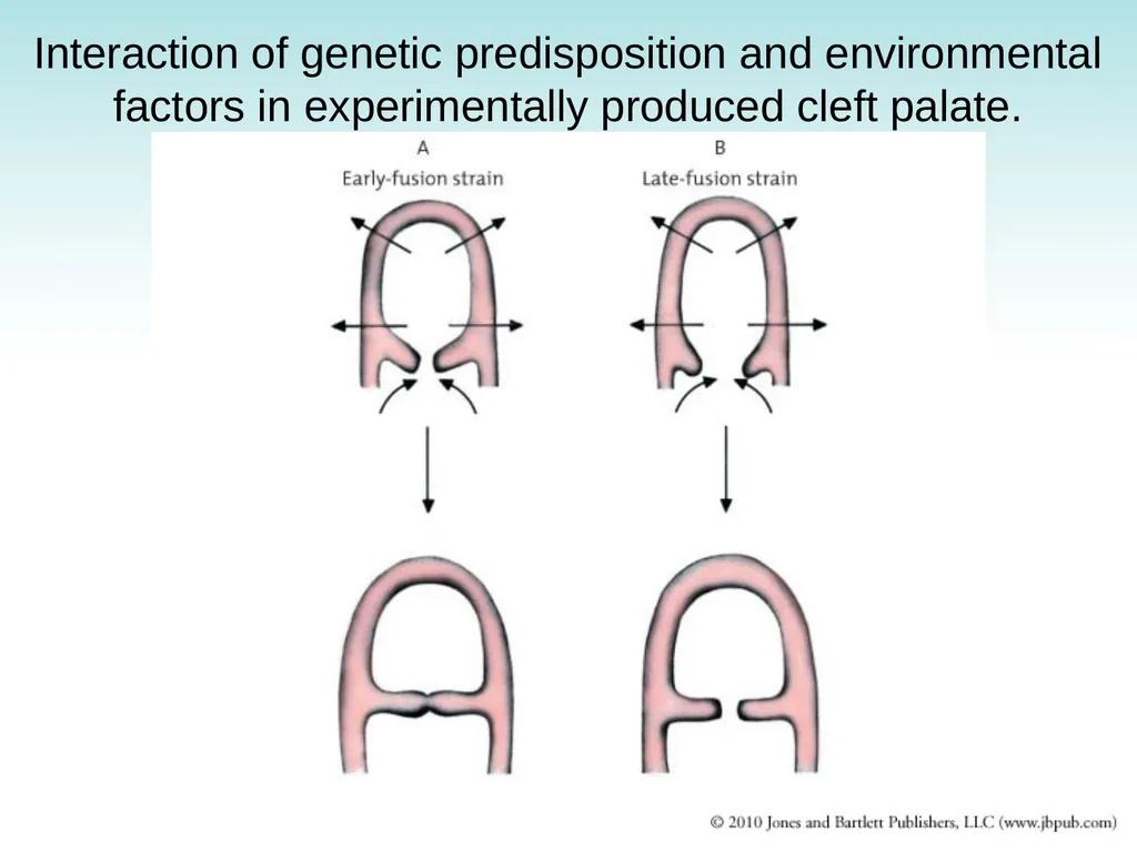 Chapter 9 Congenital and Hereditary Diseases - slide 42 of 50