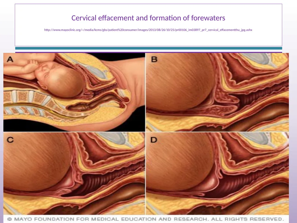 Normal Labour and Birth Objectives Define normal - slide 12 of 35