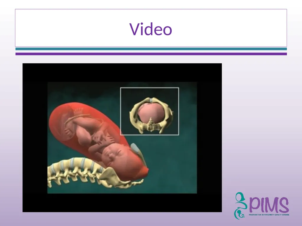 Normal Labour and Birth Objectives Define normal - slide 31 of 35