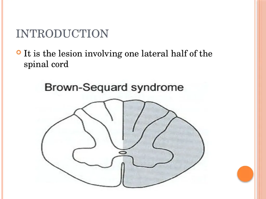 Hemi section of spinal cord - Brown sequard - slide 2 of 19