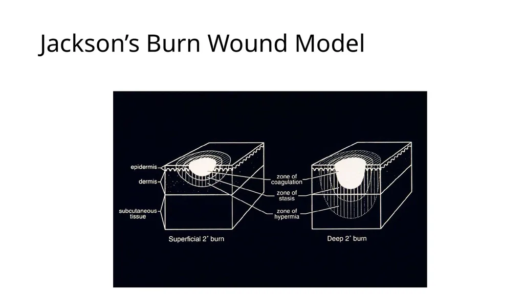 Burns in the Hand Nick Sheppard AO AF / BSSH - slide 5 of 25