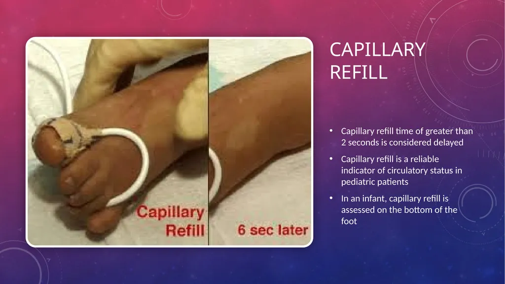 Pediatric assessment/skills Aurora first quarter - slide 29 of 43