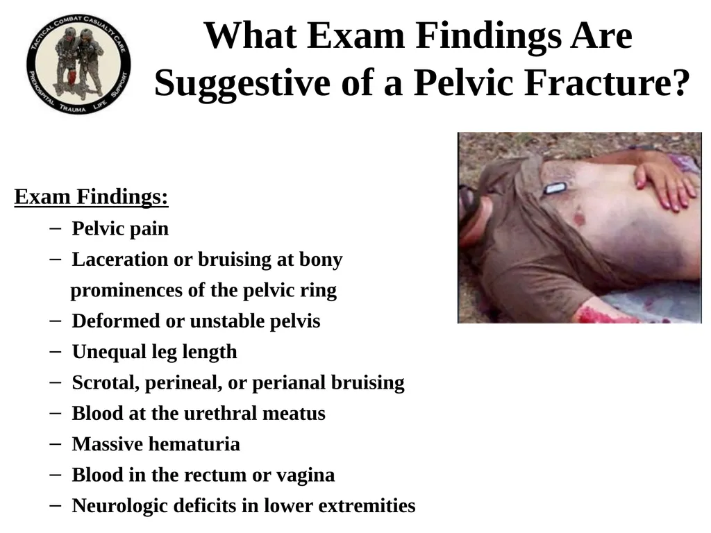 1. Remove this slide and add the remaining slides - slide 7 of 22