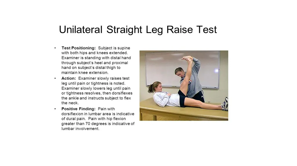 Common Back Pain Issues Presented by Brian Walker, - slide 14 of 47