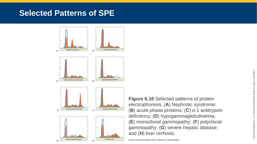 CHAPTER 6 Proteins and Heme Derivatives Learning - slide 20 of 27
