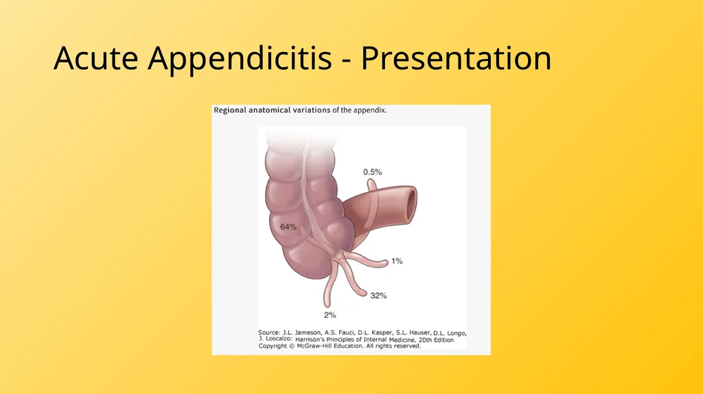Acute Appendicitis Tyler Klee University of - slide 23 of 30