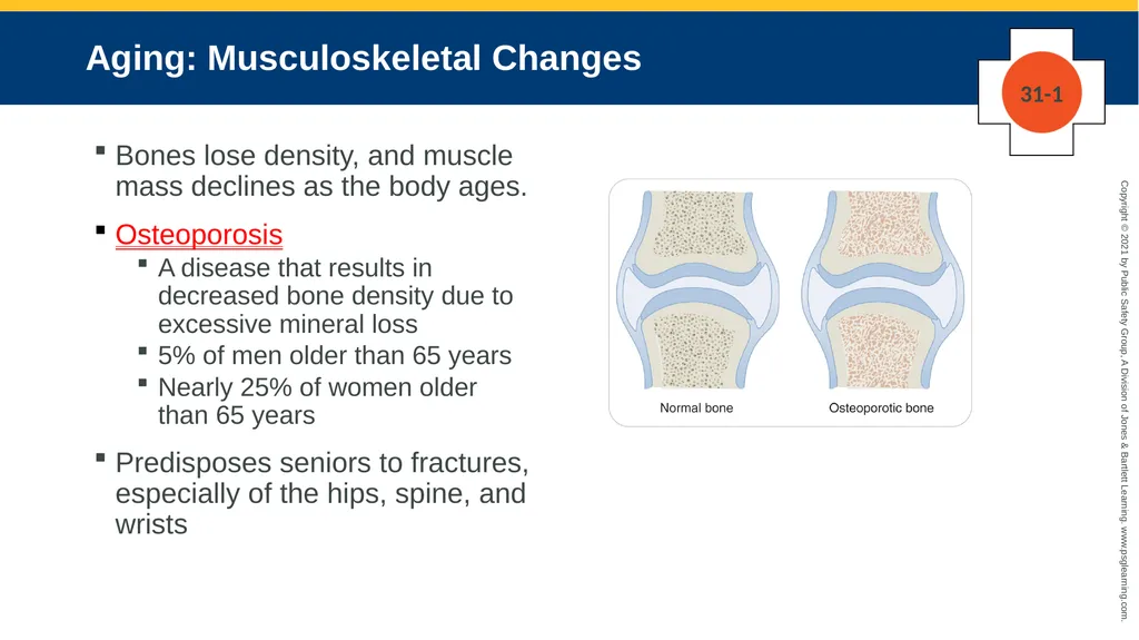 CHAPTER 31 Geriatric Emergencies The following - slide 20 of 74