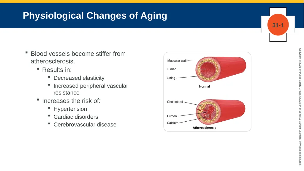 CHAPTER 31 Geriatric Emergencies The following - slide 15 of 74