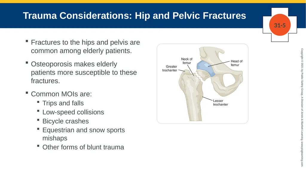 CHAPTER 31 Geriatric Emergencies The following - slide 49 of 74