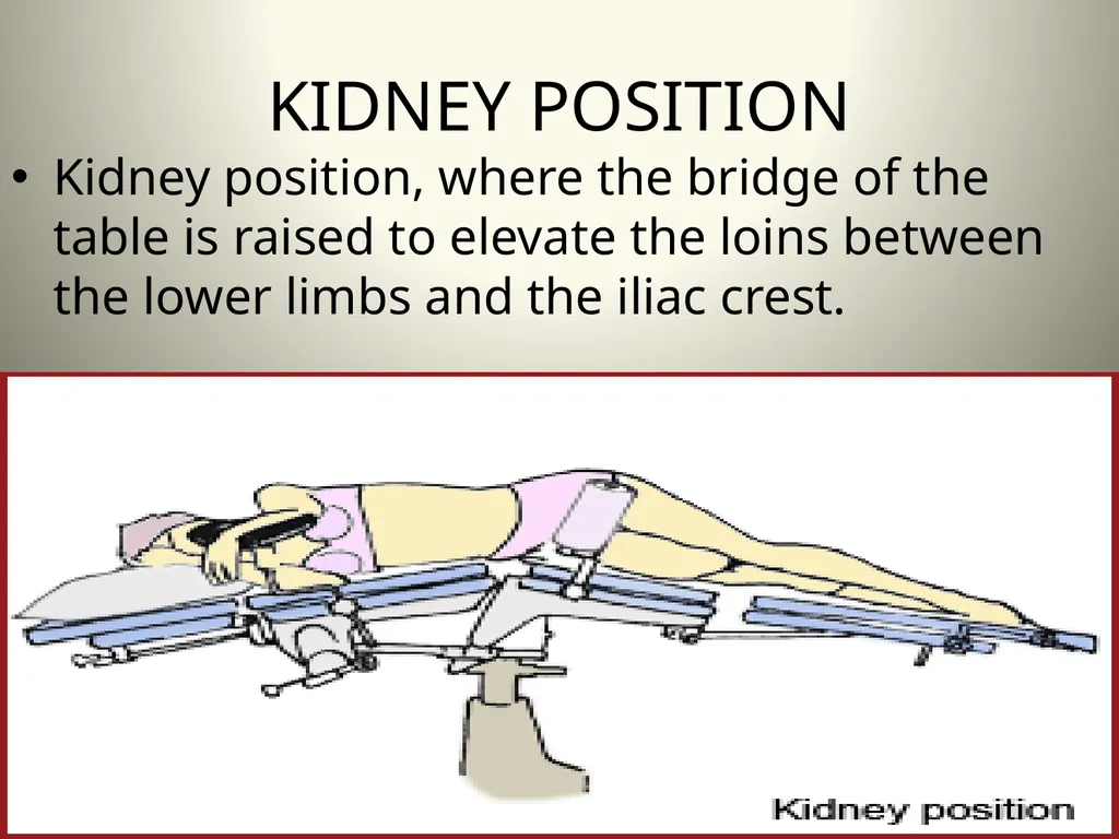 INTRODUCTION TO OPERATING THEATRE OBJECTIVES - slide 37 of 79
