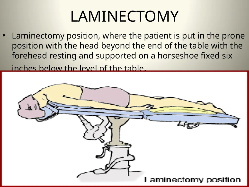 INTRODUCTION TO OPERATING THEATRE OBJECTIVES - slide 39 of 79