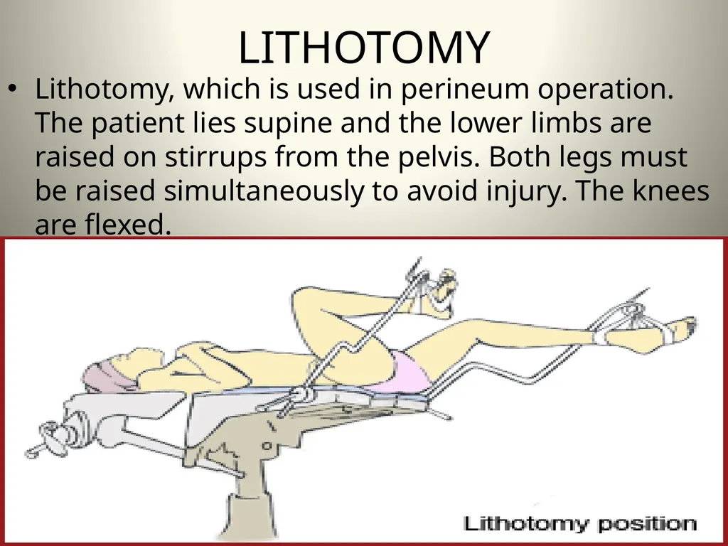 INTRODUCTION TO OPERATING THEATRE OBJECTIVES - slide 38 of 79