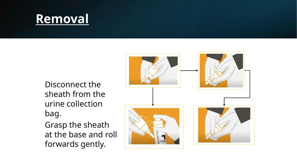 Urinary sheaths Ade Oyeniyi Bladder and Bowel - slide 11 of 13