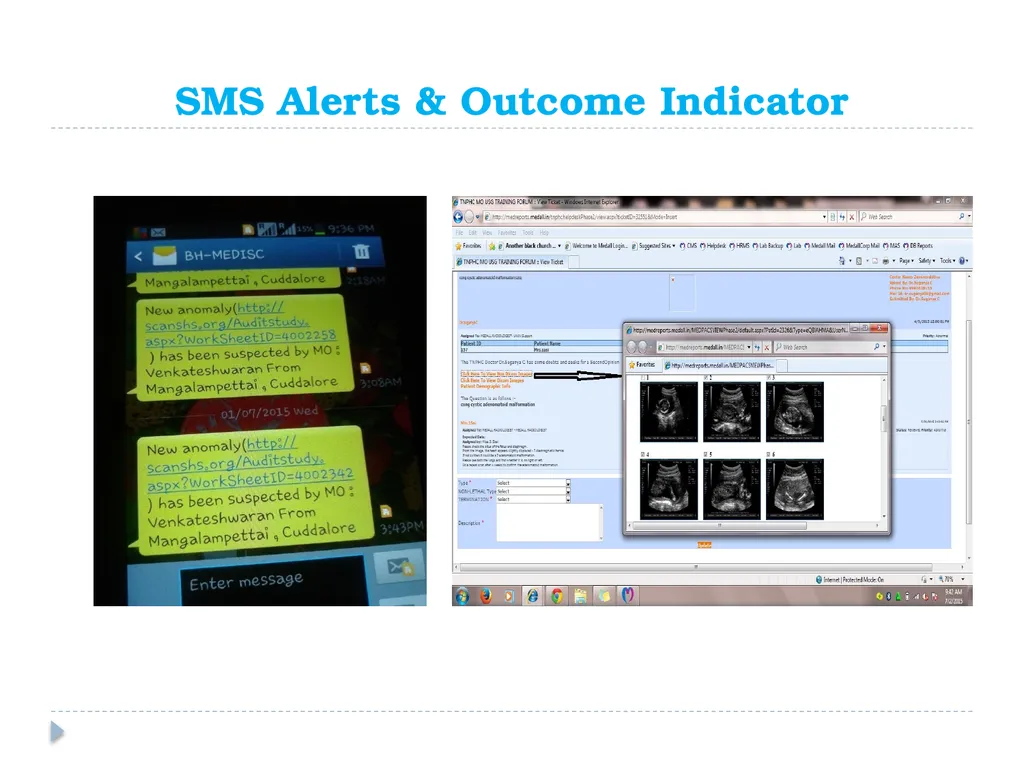 Prenatal Screening of Antenatal Mothers for - slide 19 of 22