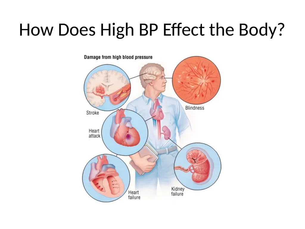 Diet and Hypertension What is Blood Pressure? The - slide 6 of 25
