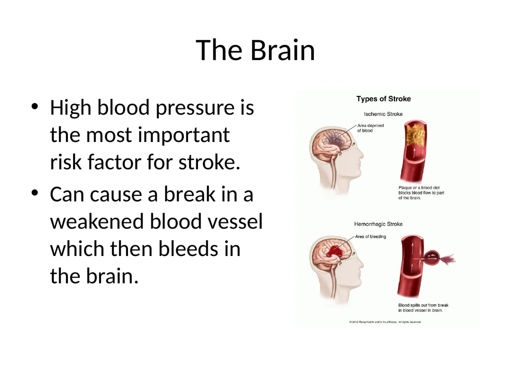 Diet and Hypertension What is Blood Pressure? The - slide 7 of 25