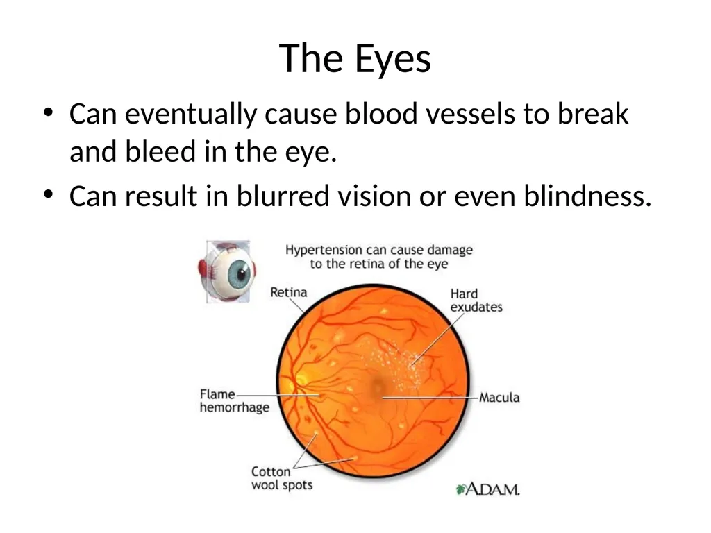 Diet and Hypertension What is Blood Pressure? The - slide 10 of 25