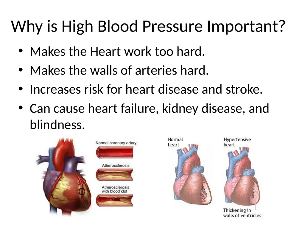 Diet and Hypertension What is Blood Pressure? The - slide 5 of 25
